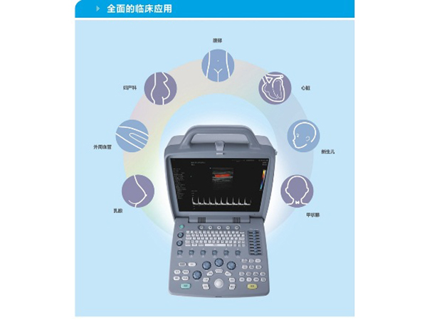 便携式彩色超声诊断仪